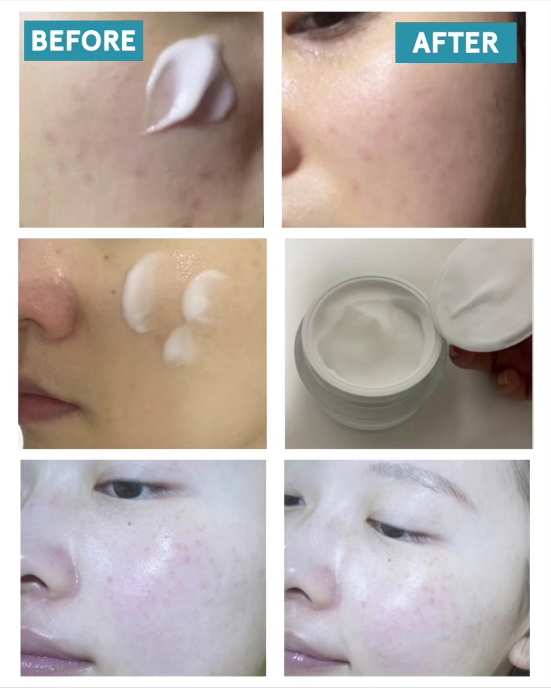 msg HIGHCERA EYE CREAM×2 HIGHCERA EYE CREAM – mgb skin global